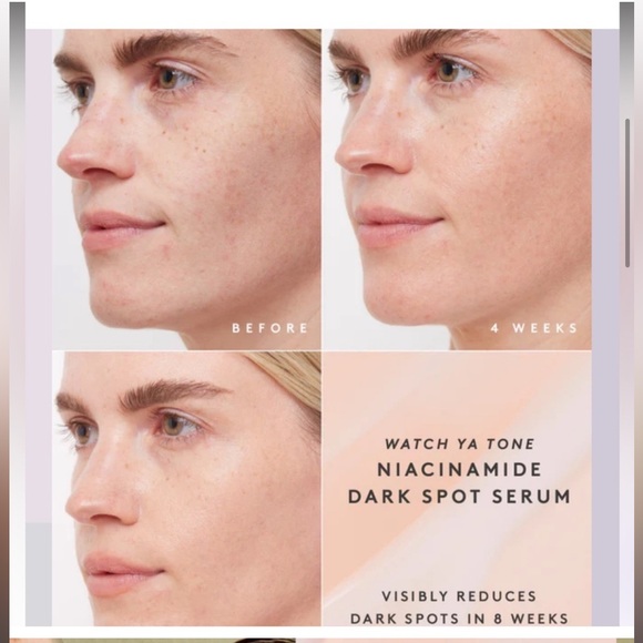 Fenty Beauty WATCH YA TONE NIACINAMIDE DARK SPOT SERUM 30ml BRAND NEW/SEALED - Picture 3 of 6